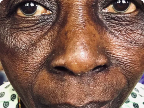 Close-up do rosto de uma pessoa idosa com rugas profundas e olhar expressivo