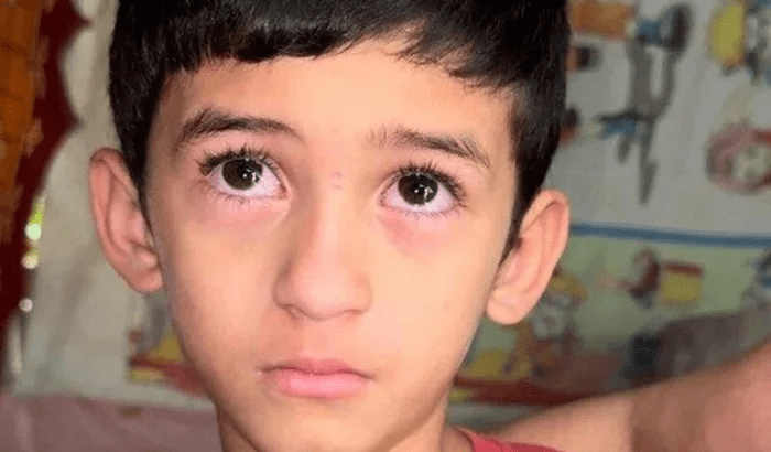 Imagem da vaquinha Garotinho come farinha com açúcar