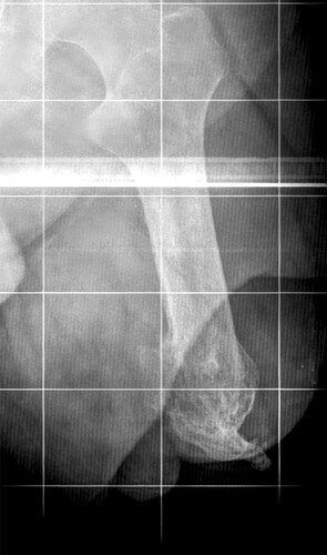 RAIO X COTO SIDNEY RIBAS