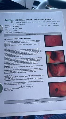 Endoscopia