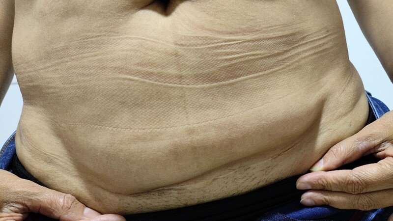 Imagem da galeria da campanha