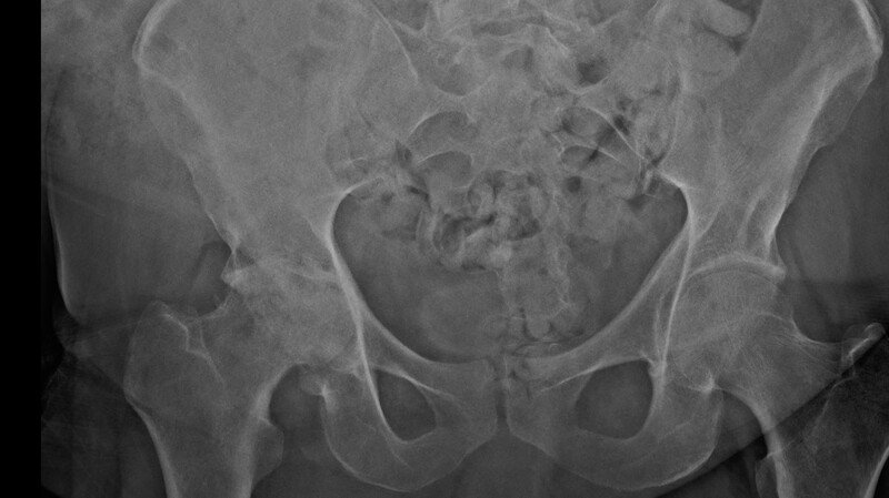 Imagem da galeria da campanha