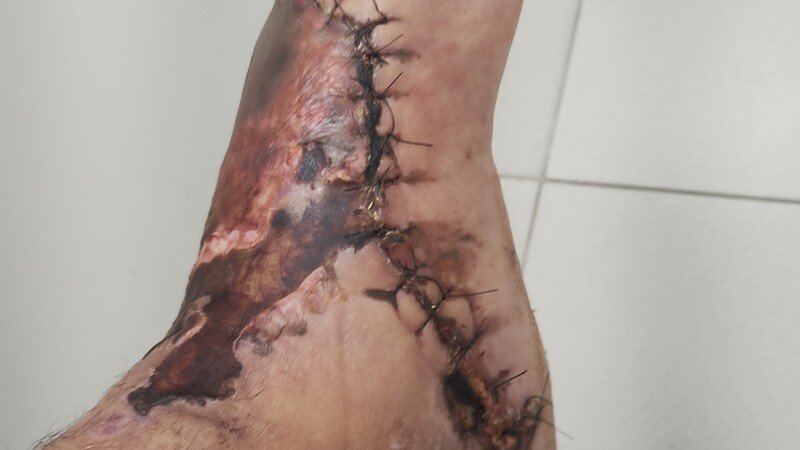 Imagem da galeria da campanha