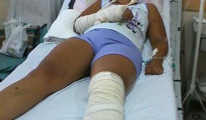 vakinha para joelho da fran !!!!