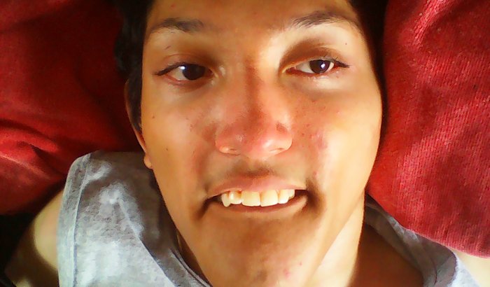 Ajude o Igor tem paralisia cerebral