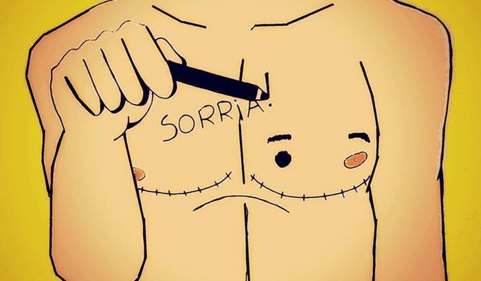 Mamoplastia do Bruno