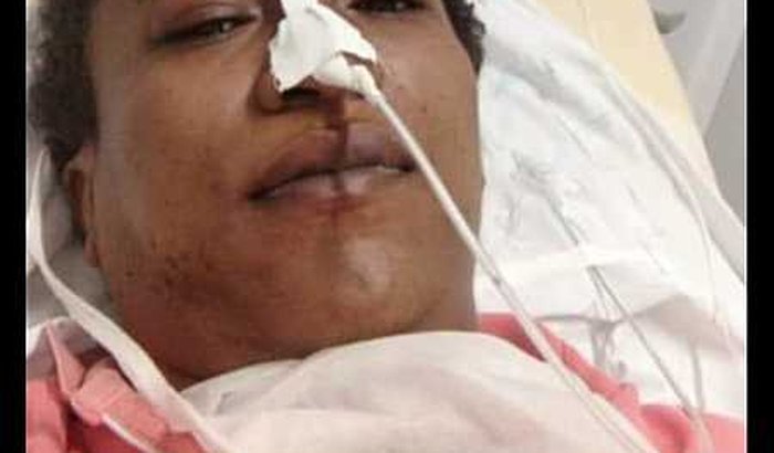 Vamos ajudar o Fran!