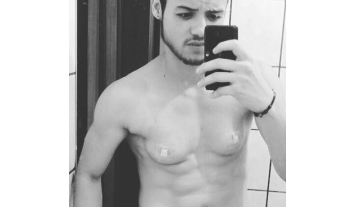 Minha mastectomia!Faça algo do bem, ajuda uma pessoa ser feliz! 
