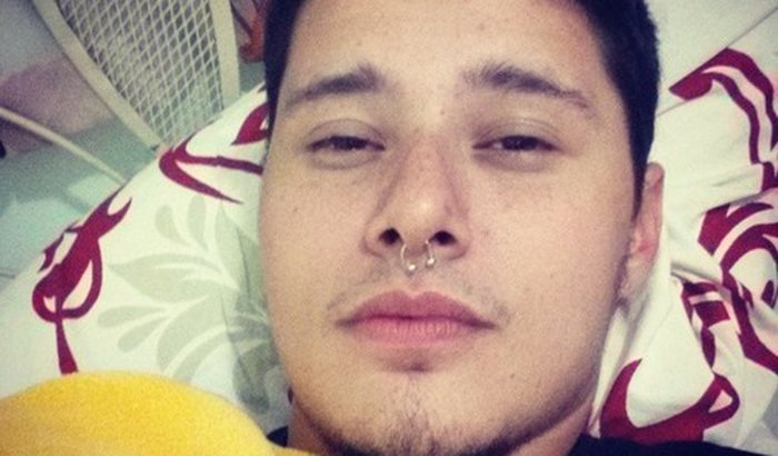 Mastectomia do Bruno 