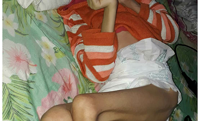 Ajude o Renan de 18 anos ,com paralisia cerebral.