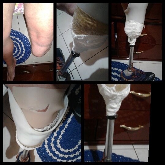 REFORMA DE PRÓTESE DE PERNA