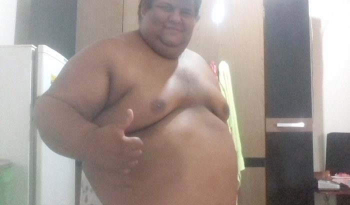 Ajuda Cirurgia Bariatrica