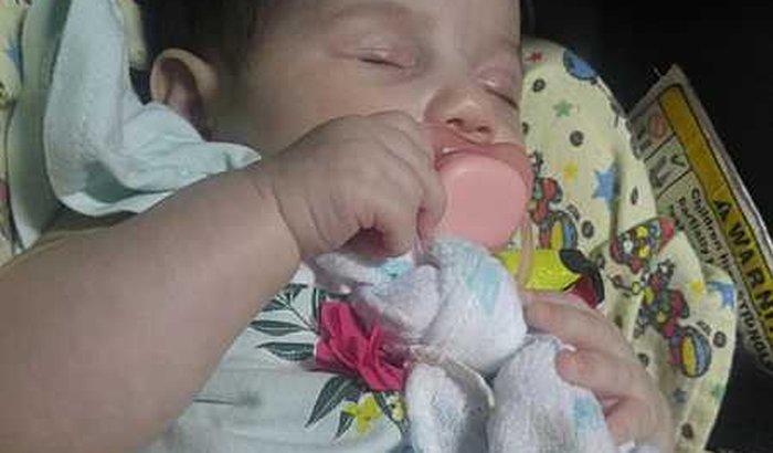 ajude a liz a fazer sua cirurgia  de Microfitalmia