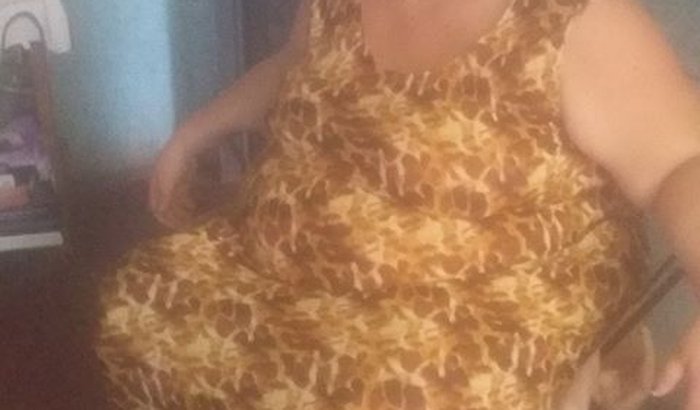 Rifa solidária - pós operatório da minha cirurgia bariátrica