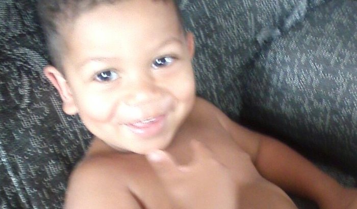 Aparelho do Anthony #vamos ajudar