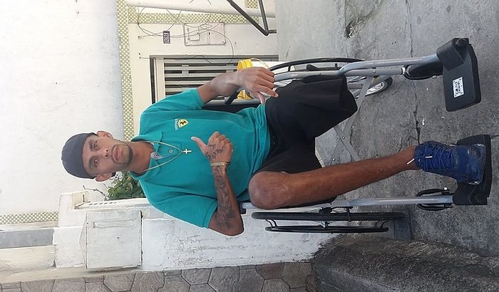 PRÓTESE PRO MOTOBOY TOMZÃO QUE PERDEU A PERNA !!!