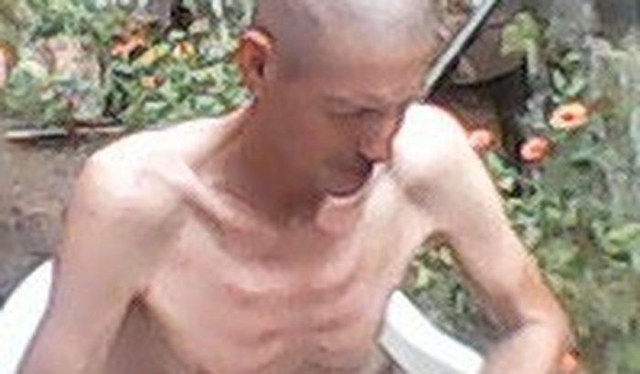 Tratamento de cancer avançado ! 