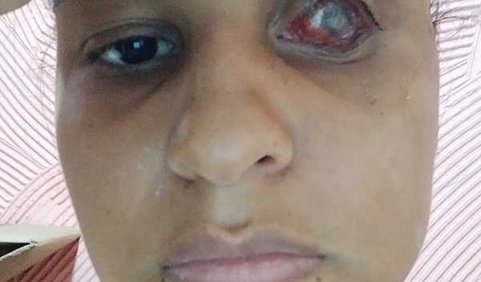 Operação Kathleen Caroline