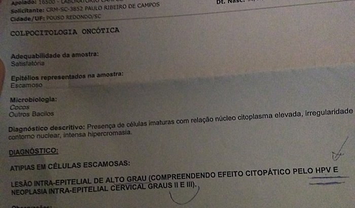 Cirurgia de Conização