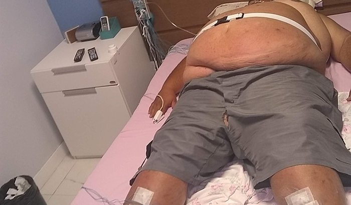 Ajuda para o Luan fazer a bariatrica