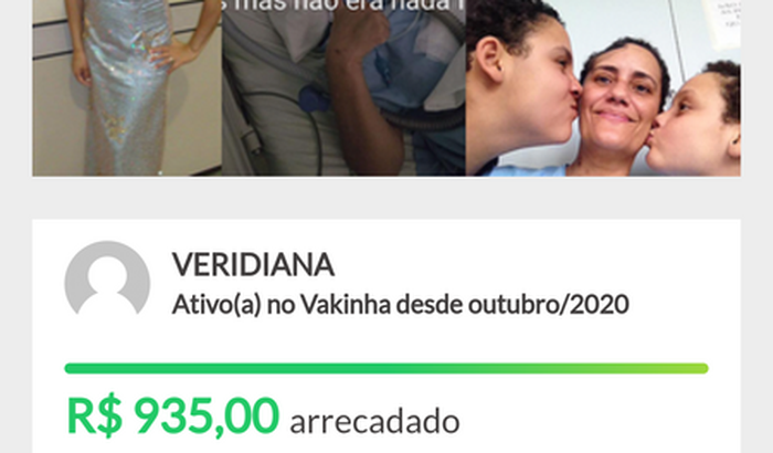 TODOS PELA VERA - Calota Craniana 