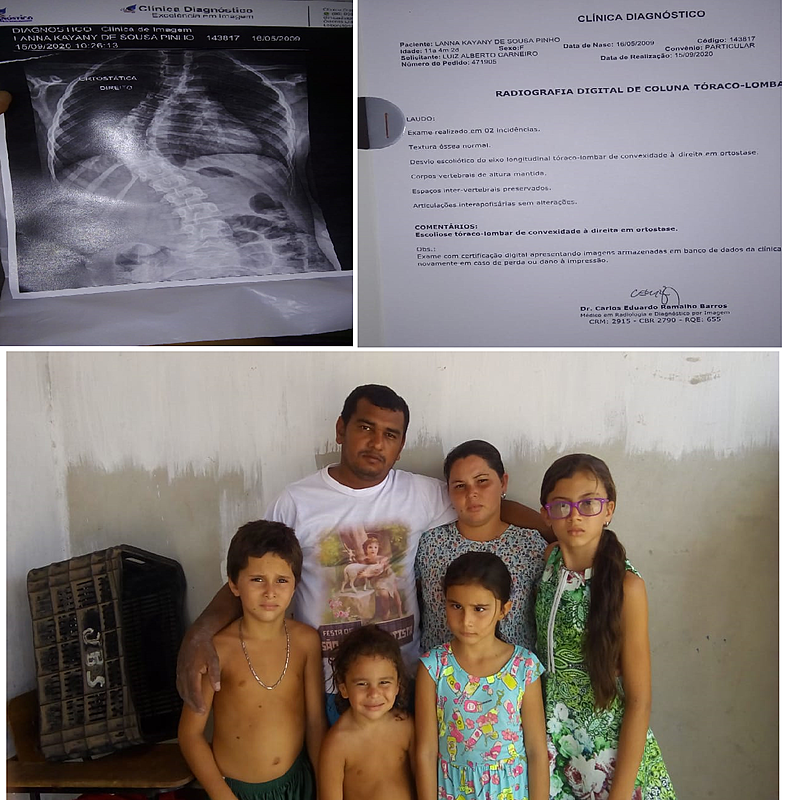imagem da vaquinha CIRURGIA DE COLUNA LOMBAR COM PINOS E PARAFUSO