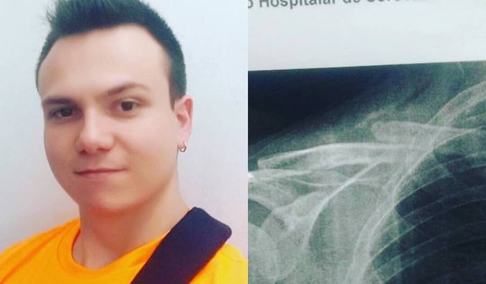 Cirurgia Clavícula Paulo Henrique
