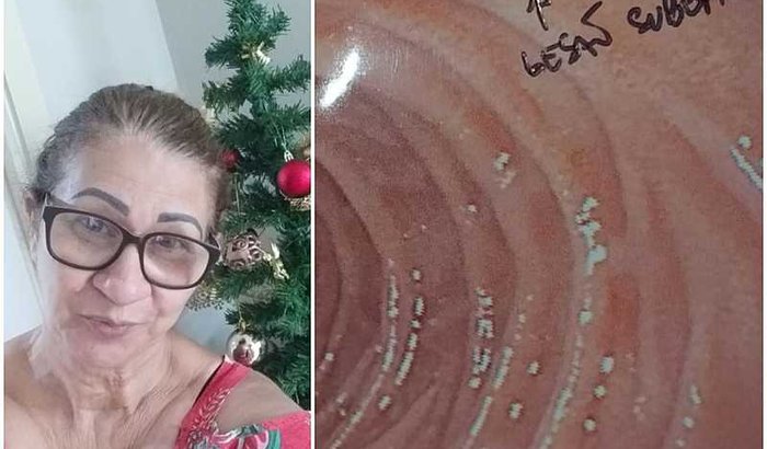 preciso fazer o exame de ecoendoscopia urgente