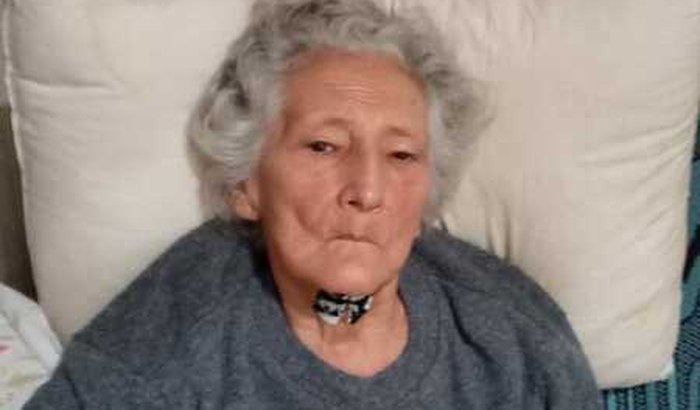 PARALISIA SUPRA NUCLEAR PROGRESSIVA