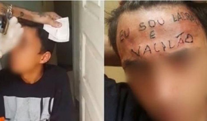 Pagar remoção de tatuagem da testa de garoto torturado....