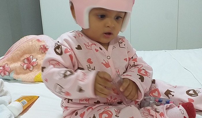 Ajude Luz no seu tratamento da Braquicefalia