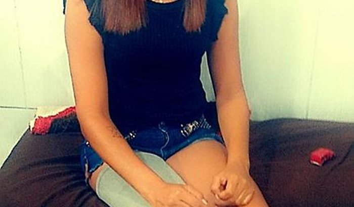 Prótese pra Jéssica