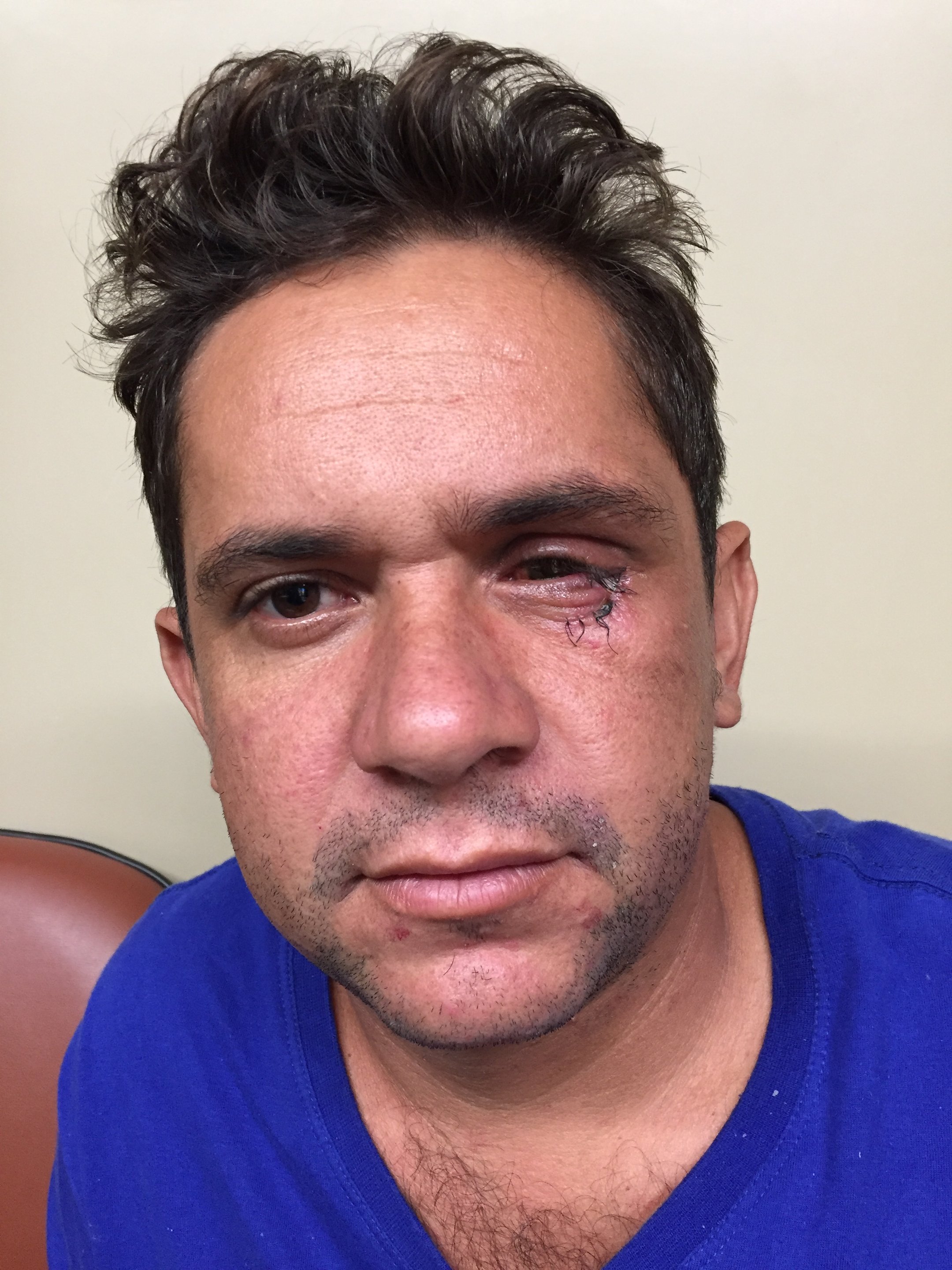 imagem da vaquinha Clemitino