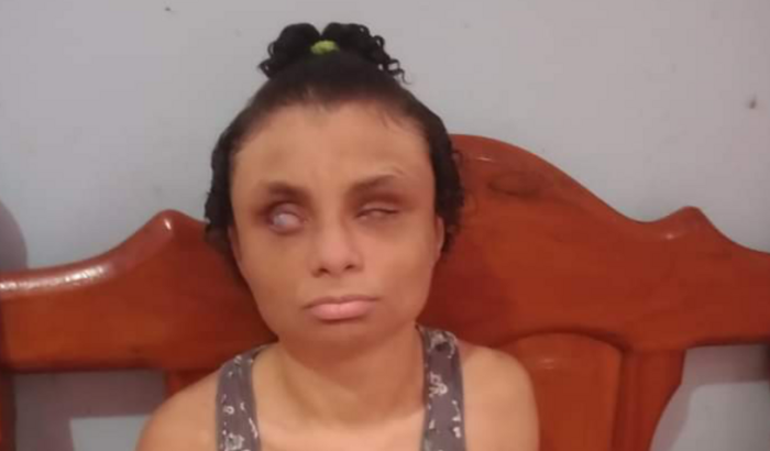 Adolescente especial# ajuda para meu tratamento