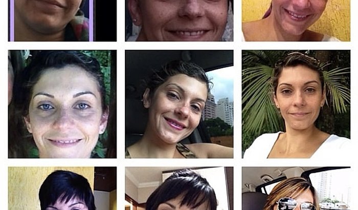 Preciso fazer minha cirurgia reconstrução de mama de câncer