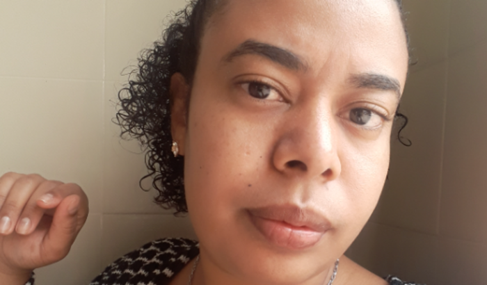 Cirurgia de Redução Mamária
