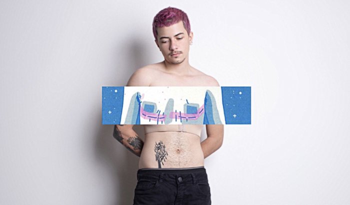 Mastectomia do Ariel