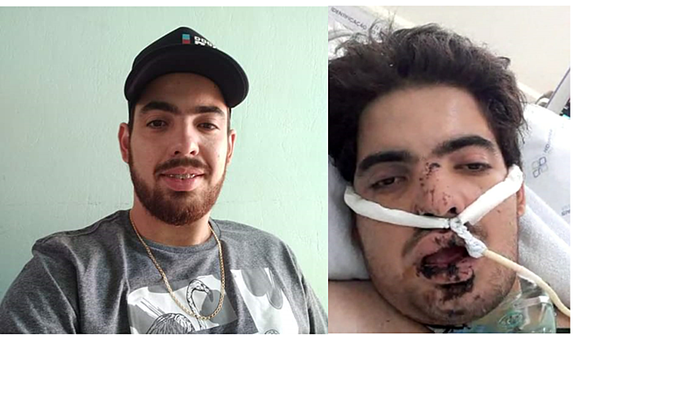 Vaquinha em prol da recuperação Raylander