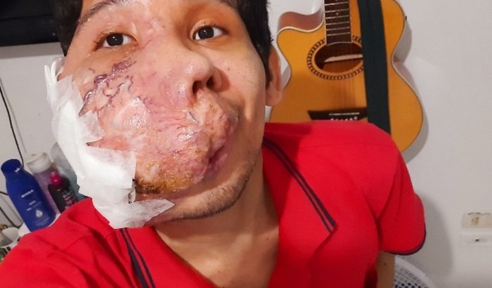 Ajude o Abraão Neves