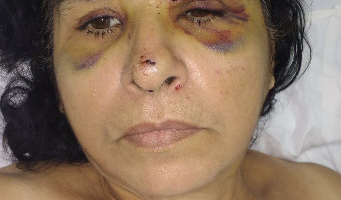 Recuperação da Maria Helena