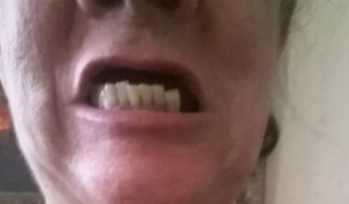 Novo Sorriso para Sônia