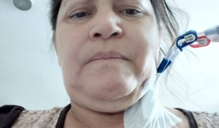 Preciso fazer uma cirurgia para colocar a fistola para acesso da hemodiálise