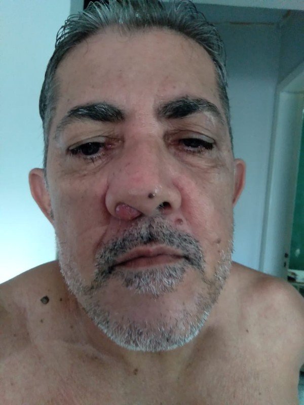 imagem da vaquinha Ajuda Solidaria p/ Cirurgia Evalto Ferreira