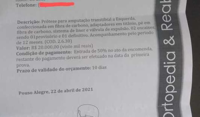 Prótese de Perna do Joaquim (Prótese Amputação Transtibial)