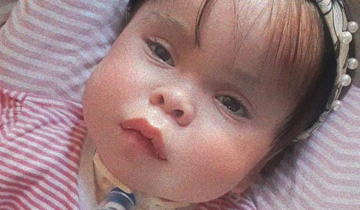 Ísis, diagnosticada com Síndrome Rara chamada Gangliosidose GM1