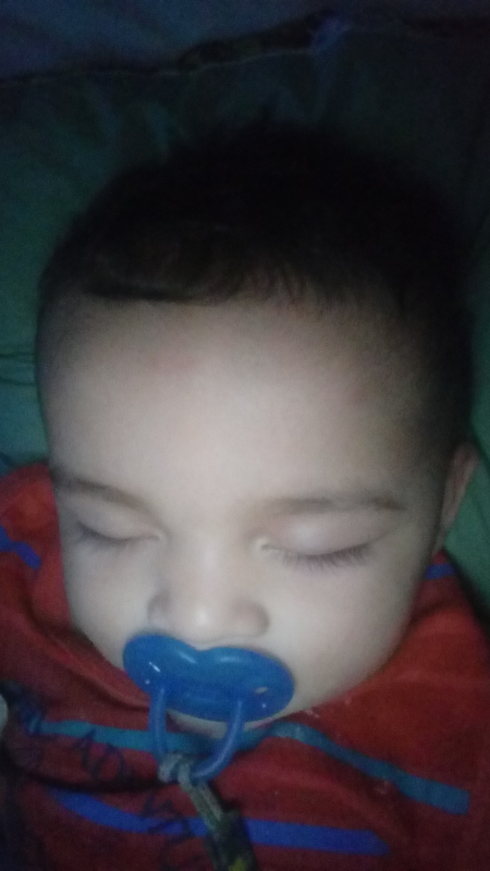 imagem da vaquinha IMPLANTE DE DRENO HIDROCEFALIA HANTONY