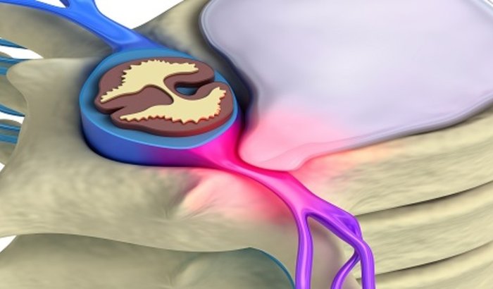 Cirurgia coluna Ricardo