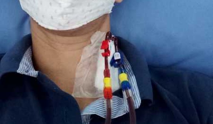 Transplantar para a vida continuar
