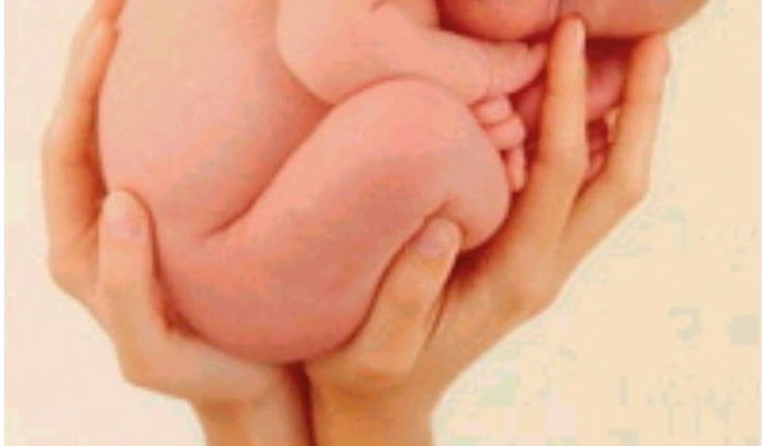 NÃO DEIXE O IBRM FECHAR