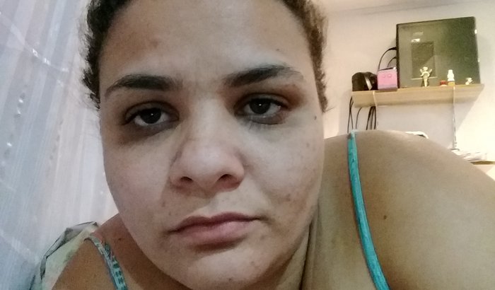 Cirurgia bariátrica
